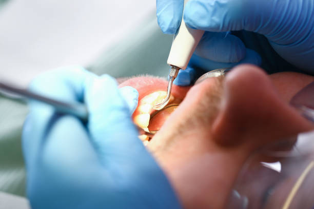 Best Walk-In Emergency Dentist in Harb, OR